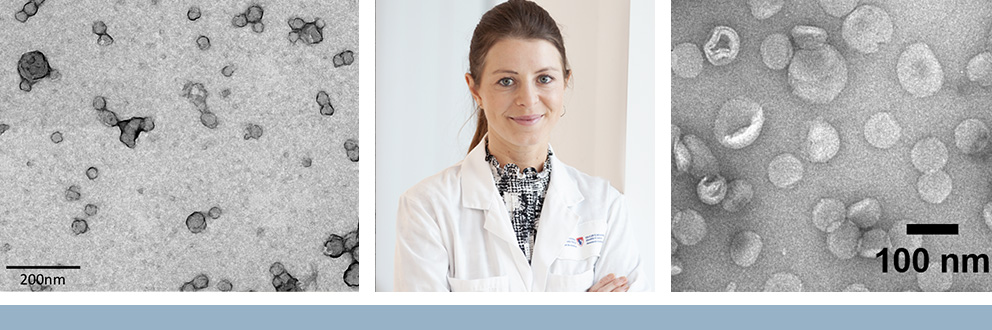 Le projet de Julia Burnier, Ph. D., va se concentrer sur la libération, par des nanoparticules lipidiques, de cellules spécifiques; il s’agit là d’un élément clé des médicaments fondés sur l’ARNm. Images de vésicules extracellulaires provenant de cellules cancéreuses et de nanoparticules lipidiques, appelées liposomes, réalisées par Thupten Tsering et Rubén López.