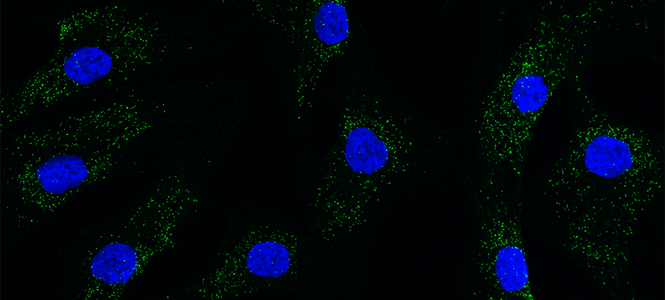 Image de microscopie confocale et d’immunofluoromicroscopie montrant la protéine PEX14 en vert attachée aux membranes du peroxysome et aux noyaux en bleu dans des fibroblastes de contrôle normaux. Image reproduite avec la permission de Xuting Sun, M. Sc.