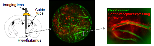 Un objectif d’imagerie spécialisé fut utilisé pour visualiser les cellules exprimant le récepteur de la leptine dans les cerveaux de souris vivantes.