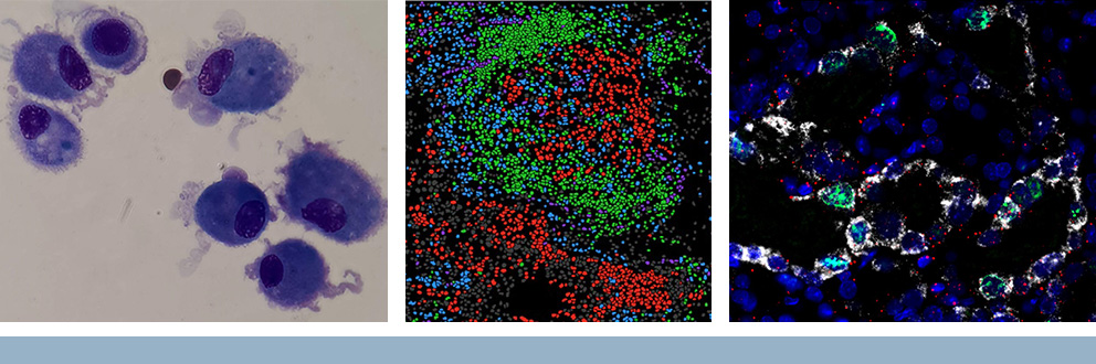 Imagerie des laboratoires des chercheurs de l'IR-CUSM Erwin Schurr, Ph. D. (macrophages alvéolaires dans une étude sur les antirétroviraux contre le VIH), Ian Watson, Ph. D. (carte de localisation des cellules dans la tumeur, ayant recours à la technologie de l’imagerie par cytométrie de masse), et Serge Lemay, M.D. (imagerie cellulaire des lésions rénales chez la souris)