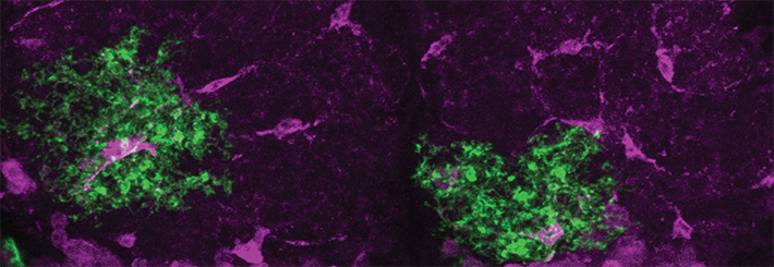 Les astrocytes (en vert) et l’enzyme AANAT1 (en magenta) jouent un rôle crucial dans l’homéostasie du sommeil chez les drosophiles.
