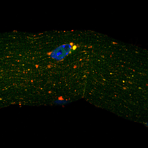 Image d'une fibre musculaire montrant la colocalisation de MYTHO (en vert) avec la protéine LAMP2 induite par le jeûne, puissant activateur de l’autophagie. Photo : Anaïs Franco-Romero