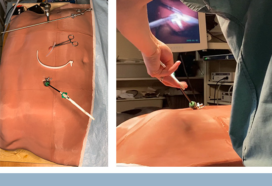 Dr. Thomas Hemmerling’s group recently developed a novel simulator for bariatric surgery.