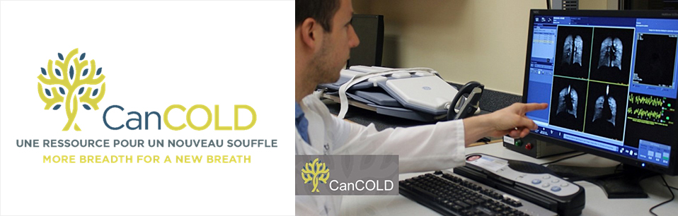 CanCOLD vise à mieux comprendre la progression et le fardeau de la MPOC, et à faciliter sa prévention, son diagnostic et sa gestion.