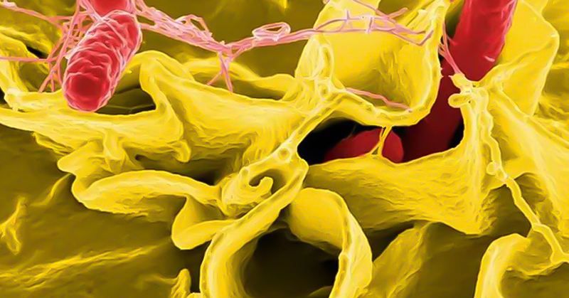 L’image ci-dessus, réalisée au moyen d’un microscope électronique à balayage et colorisée numériquement, présente des bactéries Salmonella sp. colorées en rouge en plein processus d’invasion d’une cellule immunitaire ébouriffée, colorée en jaune moutarde.