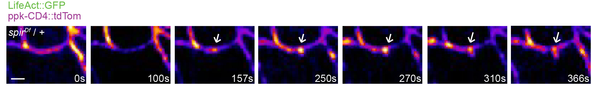 Live imaging of a burst of actin assembly just prior to outgrowth of a new dendrite branch in a Drosophila sensory neuron, captured using a Zeiss spinning disk Axio Observer Z1 microscope. (Photo: Molecular Imaging platform)