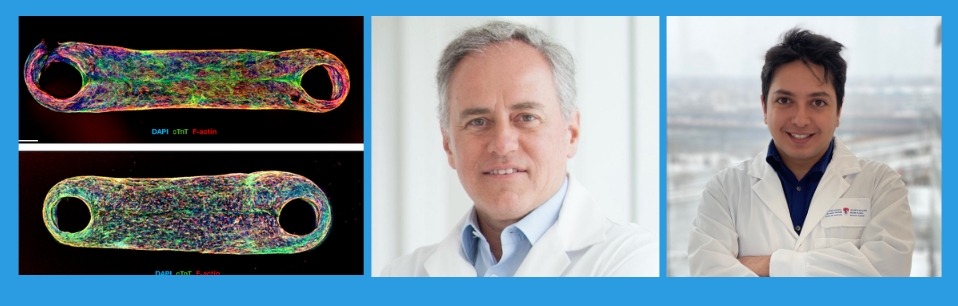 Researchers including Dr. Renzo Cecere (left) and Ali Mousavi (right) have created a three-dimensional, beating heart-on-a-chip, or “mini-heart,” using blood cells from a patient with dilated cardiomyopathy (DCM), a leading cause of heart transplantation. Researchers including Dr. Renzo Cecere (left) and Ali Mousavi (right) have created a three-dimensional, beating heart-on-a-chip, or “mini-heart,” using blood cells from a patient with dilated cardiomyopathy (DCM), a leading cause of heart transplantation.