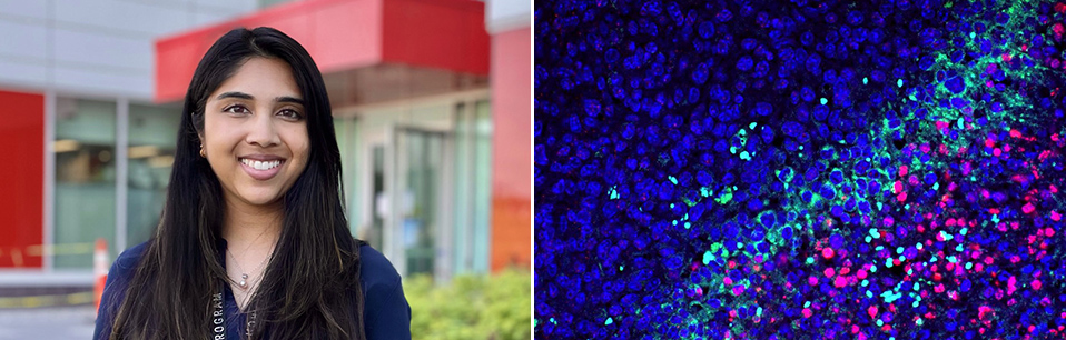RI-MUHC trainee Surashri Shinde, first author of the study, and a confocal image of tissue stained for immunofluorescence analyses