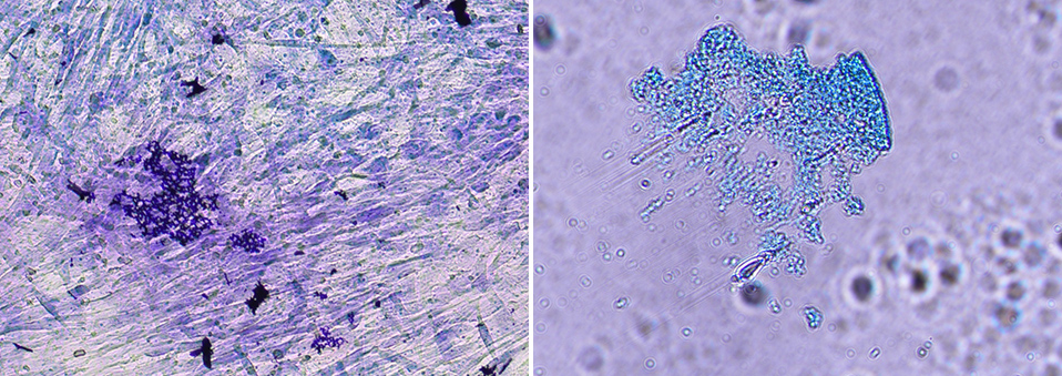 Fibroblastes et chondrocytes. Images reproduites avec la permission du Laboratoire de thérapie cellulaire.