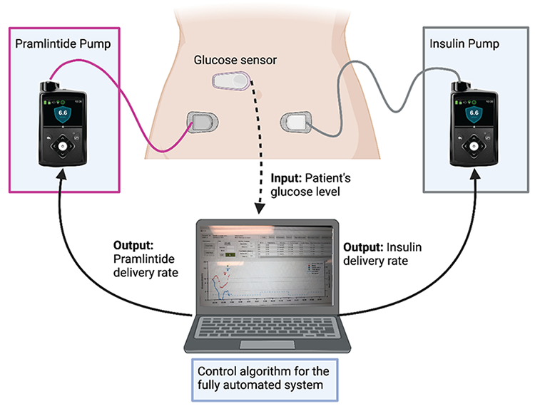 Schematic representation of the fully automated artificial pancreas (courtesy of Dorsa Majdpour, created with BioRender.com)