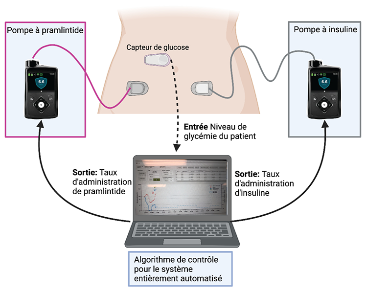 Représentation schématique du système de pancréas entièrement automatisé (reproduit avec l’aimable autorisation de Dorsa Majdpour, créé dans BioRender.com)