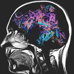 MRI, human brain