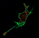 Récepteurs couplés aux protéines G sur la membrane plasmique (vert) et bêta-arrestine dans les endomes (rouge) provenant de cellules HEK293 stimulées par un agonite. Photo : Stephane Laporte