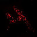 Récepteurs couplés aux protéines G sur la membrane plasmique (vert) et bêta-arrestine dans les endomes (rouge) provenant de cellules HEK293 stimulées par un agonite. Photo : Stephane Laporte
